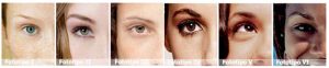 Fotoprotección: fototipos